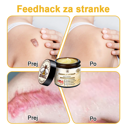🐝✨𝑩𝑺𝑾𝑬𝑳𝑳® Krema za nego kože z čebeljim strupom👨‍⚕️ (Priporočena s strani AAD) (🔥 Zadnji dan promocije, prihranite 70%)