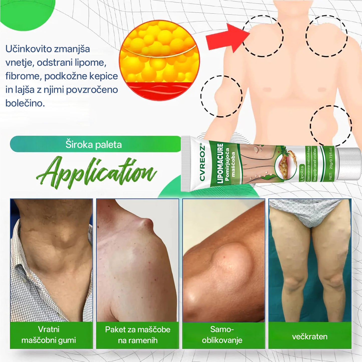 Cvreoz® KnotAway Pomirjevalno Mazilo – Pomirjevalno Mazilo za Naravno Zmanjšanje Lipomov🌿