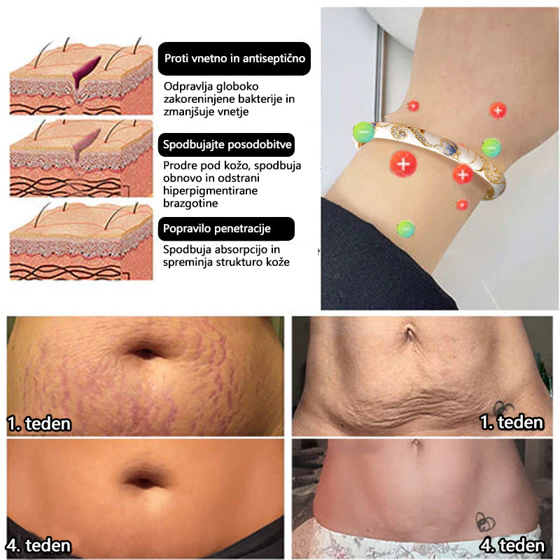𝐂𝐙𝐓𝐈𝐂𝐋𝐄™👩‍⚕️ 𝙕𝙡𝙖𝙩𝙖 𝙯𝙖𝙥𝙚𝙨𝙩𝙣𝙞𝙘𝙖 𝙯𝙖 𝙡𝙞𝙢𝙛𝙣𝙤 𝙢𝙖𝙜𝙣𝙚𝙩𝙣𝙤 𝙩𝙚𝙧𝙖𝙥𝙞𝙟𝙤 𝘾𝙡𝙤𝙞𝙨𝙤𝙣𝙣é 𝙀𝙣𝙖𝙢𝙚𝙡🔥🔥🔥