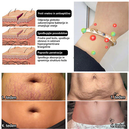 𝐂𝐙𝐓𝐈𝐂𝐋𝐄™👩‍⚕️ 𝙕𝙡𝙖𝙩𝙖 𝙯𝙖𝙥𝙚𝙨𝙩𝙣𝙞𝙘𝙖 𝙯𝙖 𝙡𝙞𝙢𝙛𝙣𝙤 𝙢𝙖𝙜𝙣𝙚𝙩𝙣𝙤 𝙩𝙚𝙧𝙖𝙥𝙞𝙟𝙤 𝘾𝙡𝙤𝙞𝙨𝙤𝙣𝙣é 𝙀𝙣𝙖𝙢𝙚𝙡🔥🔥🔥