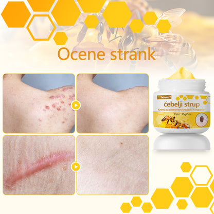 🐝Twinsun™ Izjemno Močna Krema z Čebeljim Strupom, s certifikatom EMA💖 Za zdravljenje bradavic, kožnih izrastkov, okužb in keratoze, ter za glajenje neenakomerne kože
