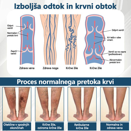 ATTDX® Črni kumen – zeliščna krema za pomiritev oteklin 🌿