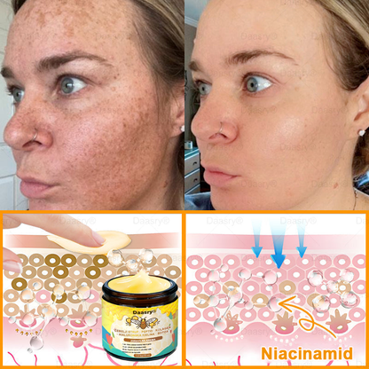Daasry® Krema z čebeljim strupom vsebuje peptide čebeljega strupa, botulin toksin, hialuronsko kislino in kolagen✨ Za gubice, drobne linije, ohlapno kožo, strije in temne madeže! 💖 Pusti, da tvoja koža postane bolj čvrsta, napeta in sijoča! ✨