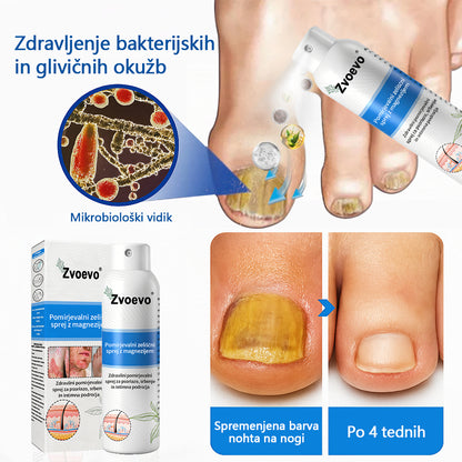 ✅ Uradna trgovina: Zvoevo® Magnezijev zeliščni sprej za luskavico ⚕️ EMA certificirano (lajša luskavico in ekcem, izboljšuje bakterijske okužbe na genitalnem področju, zdravi akne in bradavice, lajša bolečine v sklepih in nevropatske bolečine)