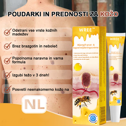 🌺𝙒𝙍𝙀𝙀™ Krema za odstranjevanje bradavic in oznak s čebeljim strupom (👨‍⚕Primerna za vse tipe kože)🐝(🔥Promocija zadnji dan 70% popust)