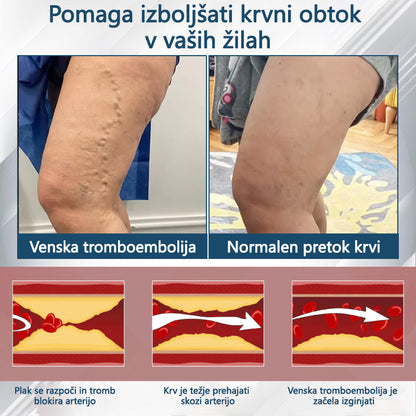 ATTDX® Črni kumen – zeliščna krema za pomiritev oteklin 🌿