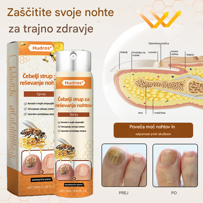 💥 2025 Omejeno 70 % CENEJE ️⏳ Ceoerty® NailRescue Kolirin pršilo proti glivicam s čebeljim strupom 💥 Vse težave z nohti lahko pozdravite v 2 tednih