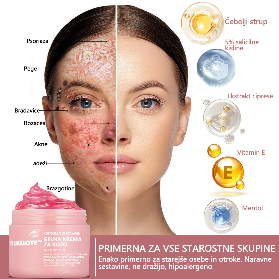 Koencim Q10 Collagen Jelly Skin Cream Odobreno Britansko združenje dermatologov (BAD) (pomaga pri aknah, bradavicah, rozacei, psoriazi, starostnih pegah, ekcemih in zmanjša videz strij)