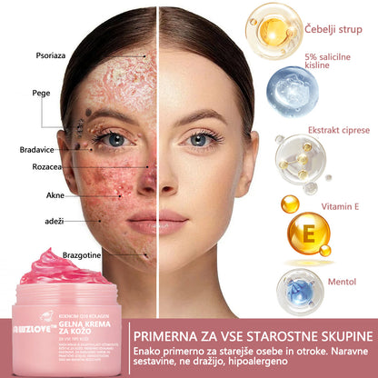 Koencim Q10 Collagen Jelly Skin Cream Odobreno Britansko združenje dermatologov (BAD) (pomaga pri aknah, bradavicah, rozacei, psoriazi, starostnih pegah, ekcemih in zmanjša videz strij)