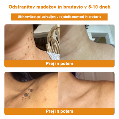 🐝✨𝑩𝑺𝑾𝑬𝑳𝑳® Krema za nego kože z čebeljim strupom👨‍⚕️ (Priporočena s strani AAD) (🔥 Zadnji dan promocije, prihranite 70%)