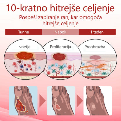 ✨👣 TOPWAL® GlucoseGuard Skin Rescue Krema – Hitrejše celjenje, varnejša zaščita in vsakodnevna hidracija za diabetično kožo 🌿💧