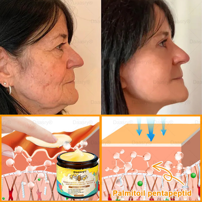 Daasry® Krema z čebeljim strupom vsebuje peptide čebeljega strupa, botulin toksin, hialuronsko kislino in kolagen✨ Za gubice, drobne linije, ohlapno kožo, strije in temne madeže! 💖 Pusti, da tvoja koža postane bolj čvrsta, napeta in sijoča! ✨