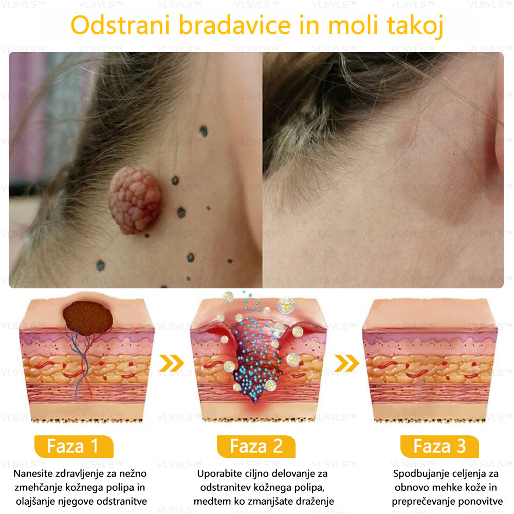 𝐕𝐋𝐒𝐕𝐋𝐒™ 𝐊𝐫𝐞𝐦𝐚 𝐳𝐚 𝐨𝐛𝐧𝐨𝐯𝐨 𝐤𝐨ž𝐞 𝐜𝐞𝐥𝐨𝐭𝐧𝐞𝐠𝐚 𝐭𝐞𝐥𝐞𝐬𝐚 – (🧑‍⚕️ Strokovno priporočilo 🤩 Dobitnik nagrade Readers' Choice Award 2024)