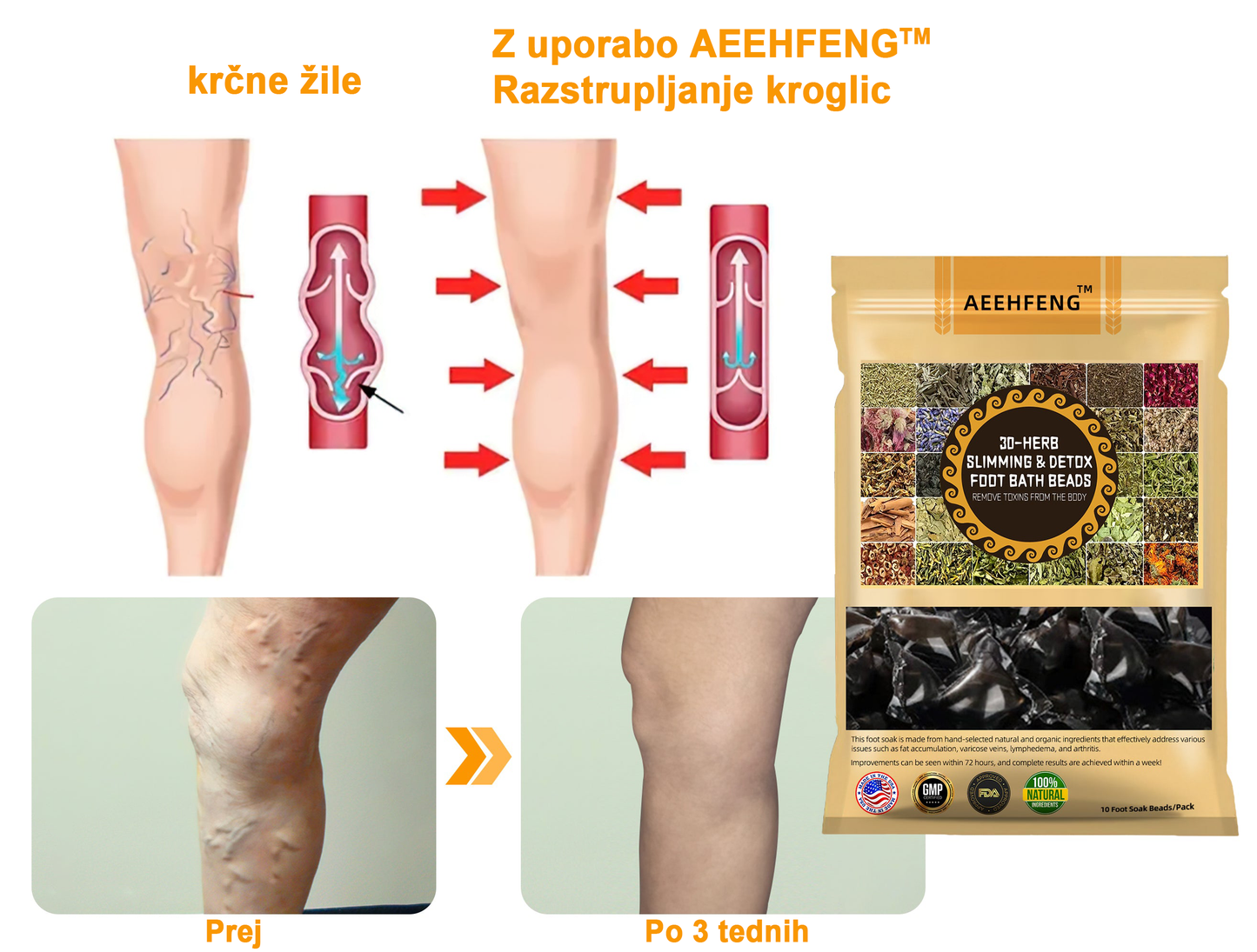 𝐀𝐞𝐞𝐡𝐟𝐞𝐧𝐠™ 𝐙𝐞𝐥𝐢šč𝐧𝐞 𝐫𝐚𝐳𝐬𝐭𝐫𝐮𝐩𝐥𝐣𝐞𝐯𝐚𝐥𝐧𝐞 𝐤𝐫𝐨𝐠𝐥𝐢𝐜𝐞 𝐳𝐚 𝐯𝐞𝐧𝐞 𝐳𝐚 𝐤𝐨𝐩𝐞𝐥 𝐧𝐨𝐠🦵👩‍⚕️ (LANA Certification, European Lymphology Association)