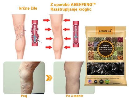 𝐀𝐞𝐞𝐡𝐟𝐞𝐧𝐠™ 𝐙𝐞𝐥𝐢šč𝐧𝐞 𝐫𝐚𝐳𝐬𝐭𝐫𝐮𝐩𝐥𝐣𝐞𝐯𝐚𝐥𝐧𝐞 𝐤𝐫𝐨𝐠𝐥𝐢𝐜𝐞 𝐳𝐚 𝐯𝐞𝐧𝐞 𝐳𝐚 𝐤𝐨𝐩𝐞𝐥 𝐧𝐨𝐠🦵👩‍⚕️ (LANA Certification, European Lymphology Association)
