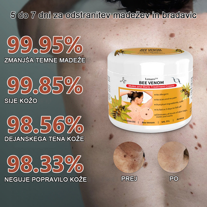 🐝 Krema Lenaro™ za zdravljenje madežev in bradavic 💎💎💎Primerna za vse starostne kategorije🐝
