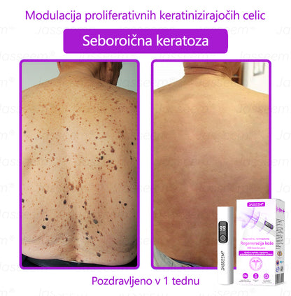 𝐉𝐚𝐬𝐬𝐞𝐞𝐦® Napredni neinvazivni CO₂ laserski pisalo za obnovo kože 🛫 (Nežno odstrani bradavice, materina znamenja, starostne pege in kožne izrastke – brez bolečin in brez kompliciranja!)