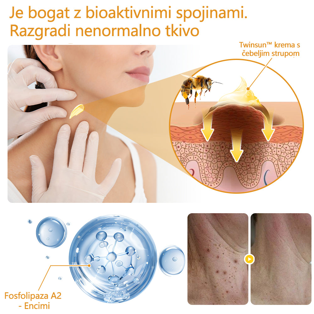 🐝Twinsun™ Izjemno Močna Krema z Čebeljim Strupom, s certifikatom EMA💖 Za zdravljenje bradavic, kožnih izrastkov, okužb in keratoze, ter za glajenje neenakomerne kože