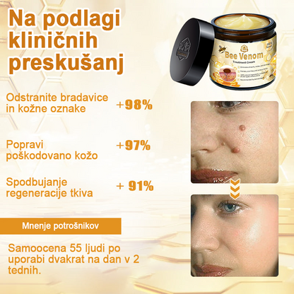 🍊𝑻𝒖𝒓𝒐𝒏𝒖™ Zdravilno mazilo s čebeljim strupom (👨‍⚕𝐀𝐀𝐃 PRIPOROČILA)