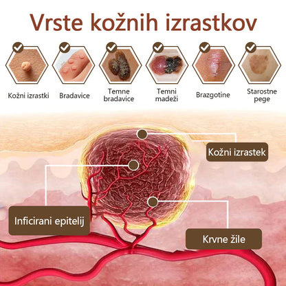 Zvoevo® Black Rice Skin Repair Essence Cream ⚕️ Certificirano pri EU (Odstranjuje bradavice in kožne izrastke, lajša luskavico, izboljšuje kopičenje keratina in folikularno keratinizacijo, posvetli pigmentacijo, sončne pege in starostne pege)