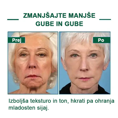 🌿Osvežite kožo v samo treh dneh💝𝙁𝙪𝙗𝙨𝙩𝙖™ pomlajevalni in učvrstitveni serum🔥