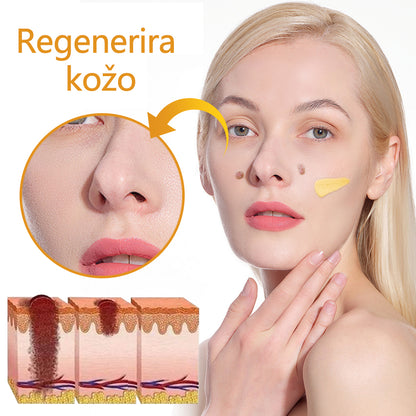 🐝Twinsun™ Izjemno Močna Krema z Čebeljim Strupom, s certifikatom EMA💖 Za zdravljenje bradavic, kožnih izrastkov, okužb in keratoze, ter za glajenje neenakomerne kože