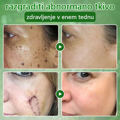 ✅ Certificirano s strani JAZMP 🌿 Zvoevo® Krema z oljem čajevca – Odpravlja nepravilnosti na koži, obnavlja poškodovano kožo, posvetli polt in nudi nego proti staranju 🌳