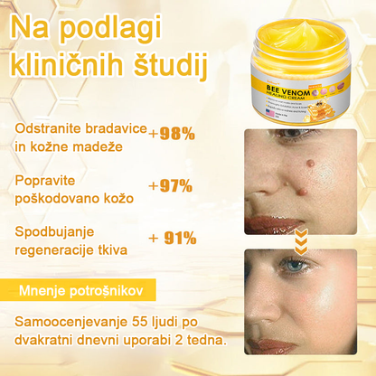 𝑽𝒆𝒍𝒊𝒔𝒔𝒆™ 2024 (priporoča AAD), za odstranjevanje bradavic, aken in brazgotin. Zdravi različne kožne bolezni